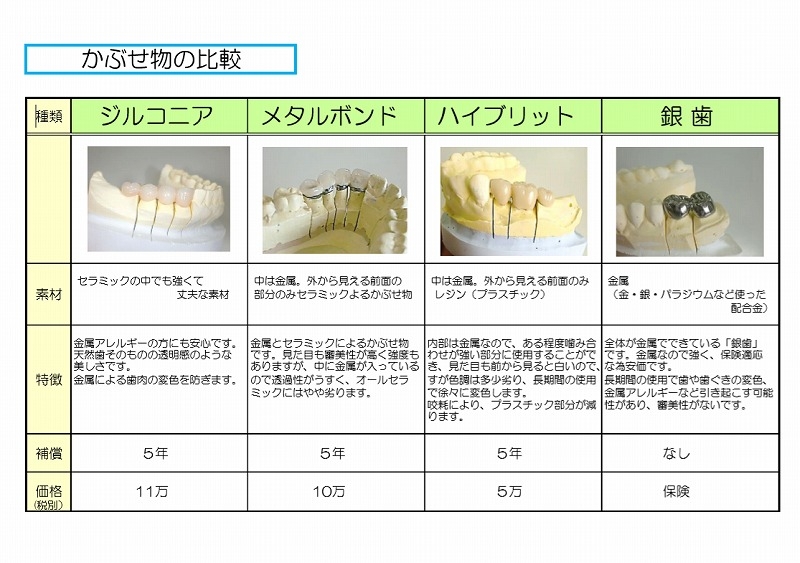 セラミック 歯 値段